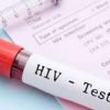 hiv